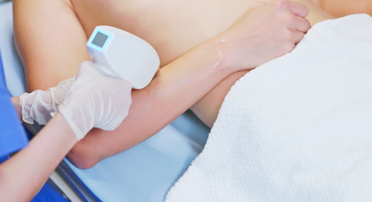 male-laser-arm-removal
